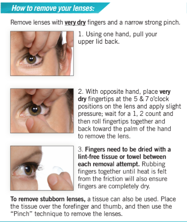 Removing SynergEyes Hybrid lenses