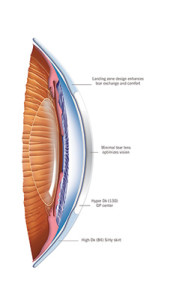 synergeyes duette progressive Überblick