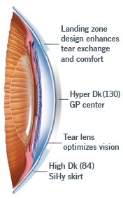 synergeyes duette Überblick