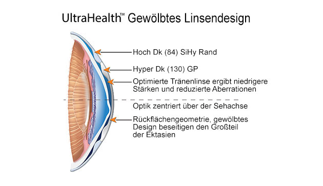 ultrahealth gewölbtes linsendesign DE