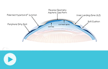 ultraHealth lens design video